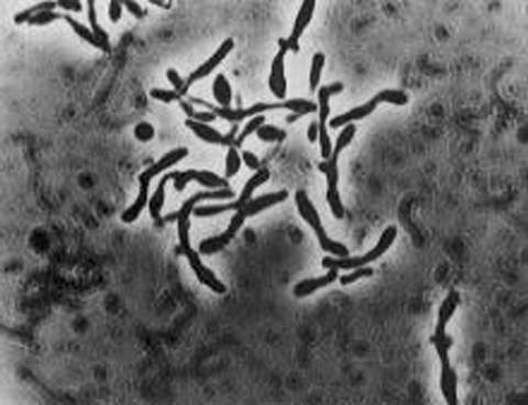 Bacteria Reverses Autistic Symptoms