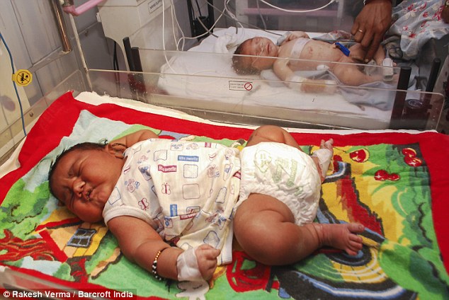 Biggest baby ever born in India is a massive 13lb