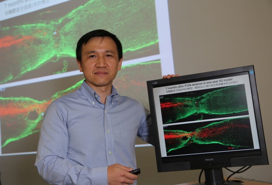 軸突受損致功能喪失 科大兩新法研神經再生